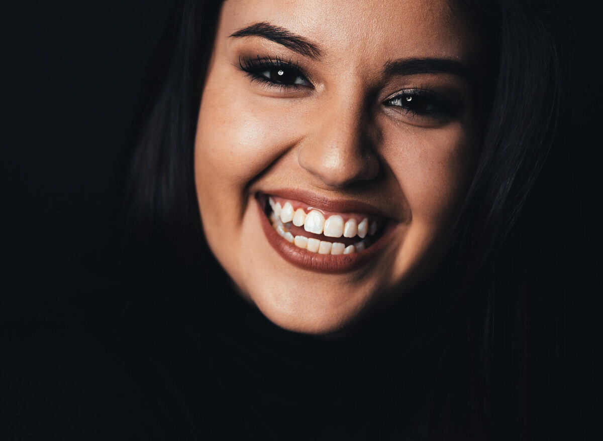 Allineatori dentali all in per hostess di Roma e dintorni